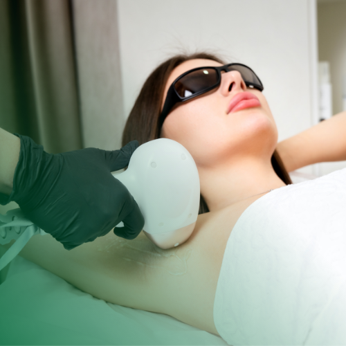 Lazer Epilasyon Pürüzsüz ve Kalıcı Bir Çözüm